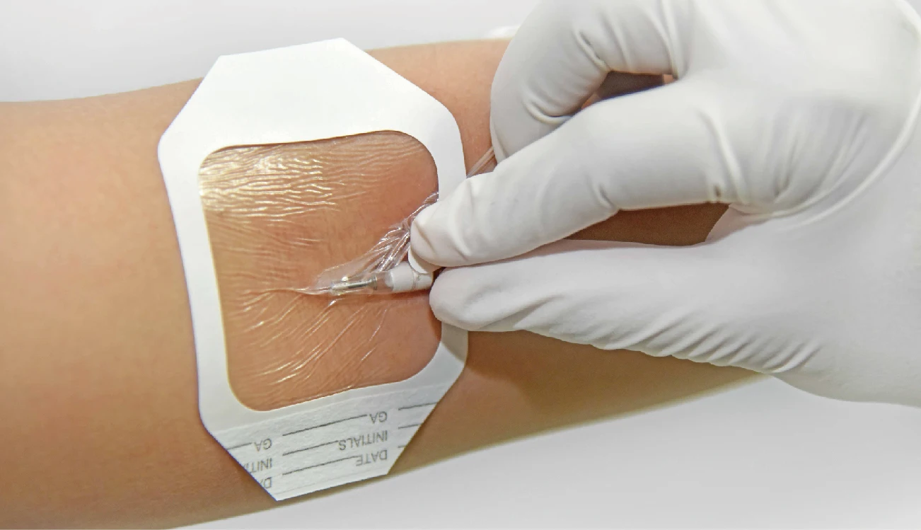 100 Waterproof Medical Transparent Film Dressing Buy Film Dressing