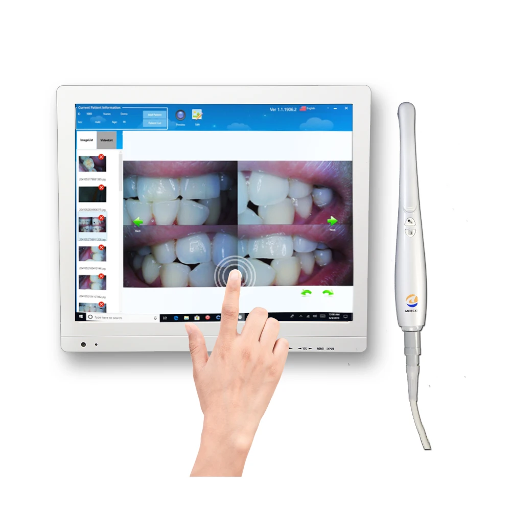 Aicreate A6mx Hd Digital Oral Camera Wifi Dental Intraoral Camera All