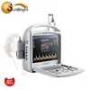 128 Elements Portable Mobile Ultrasound System 2D