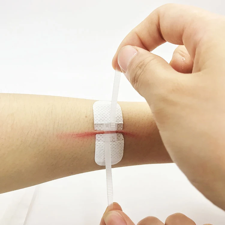 3 Pieces/set Zipper Bandaid Wound Closure Patch Hemostatic Patch Wound Fast Suture Zipper Band