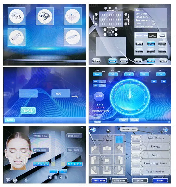 SW-139B_ENP2_Details (2)