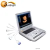 Laptop 3d color usb probe ultrasound for computer/ultrasound portable
