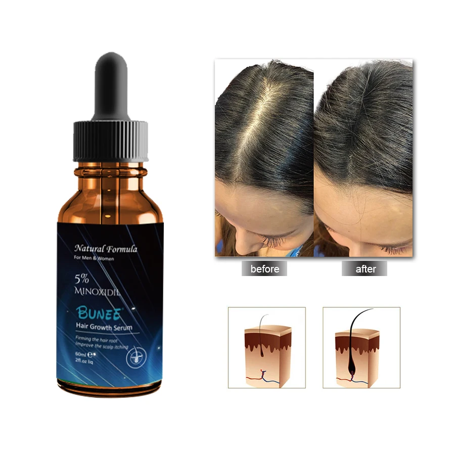 

5% Minoxidil Thin Hair Solution for Men Use 50ml Regrowth Oil Plant Extract Serum