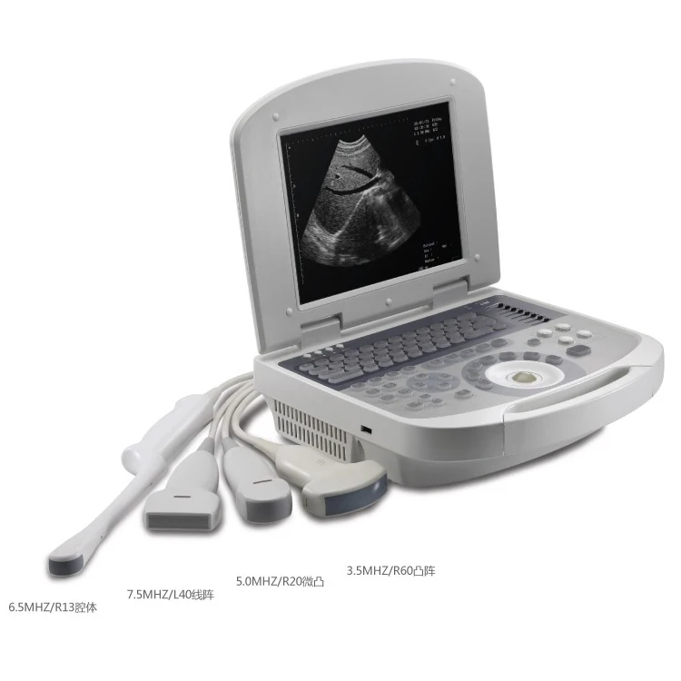 Popular human buy Veterinary Portable full digital 3D laptop ultrasound system price Instruments scanner for sale