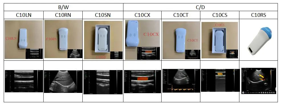 Wireless probe ultrasound