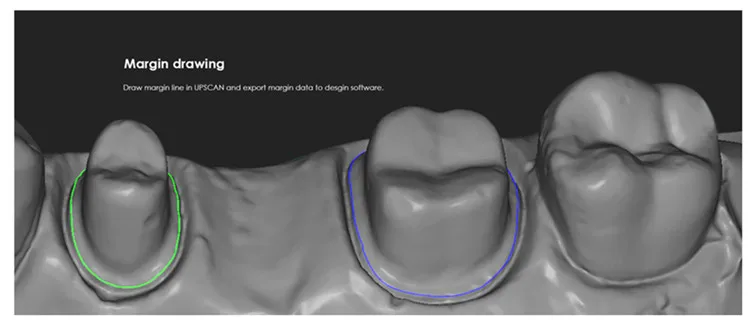 Scanner dentaire 3D, grossissement à 360 degrés, up3d