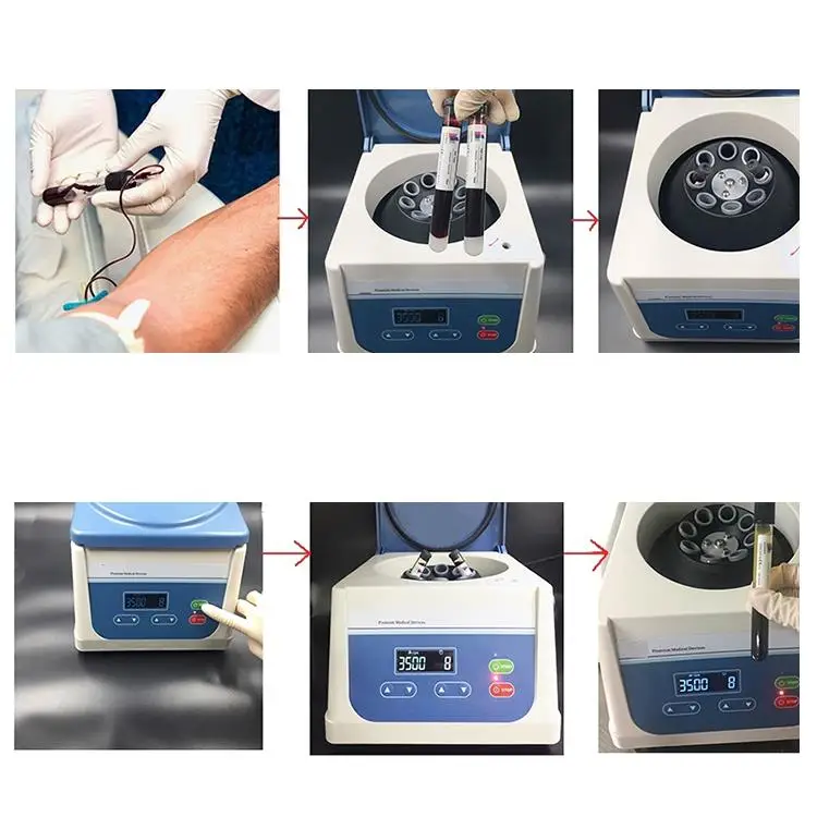 Lab Centrifuge 80 2b Blood Prp Machine Buy Centrifuge Kit Prp Machine