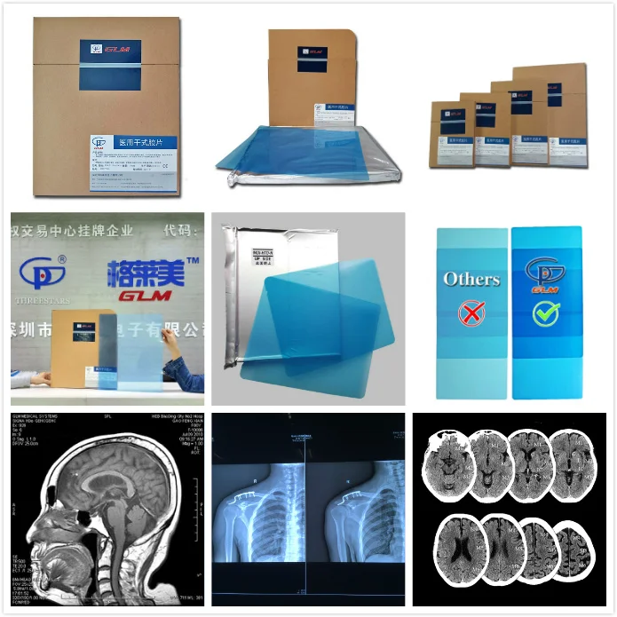 Made In China Blue 10x12inch 25x30cm Fuji Diht Di Ht Dry Thermal X Ray