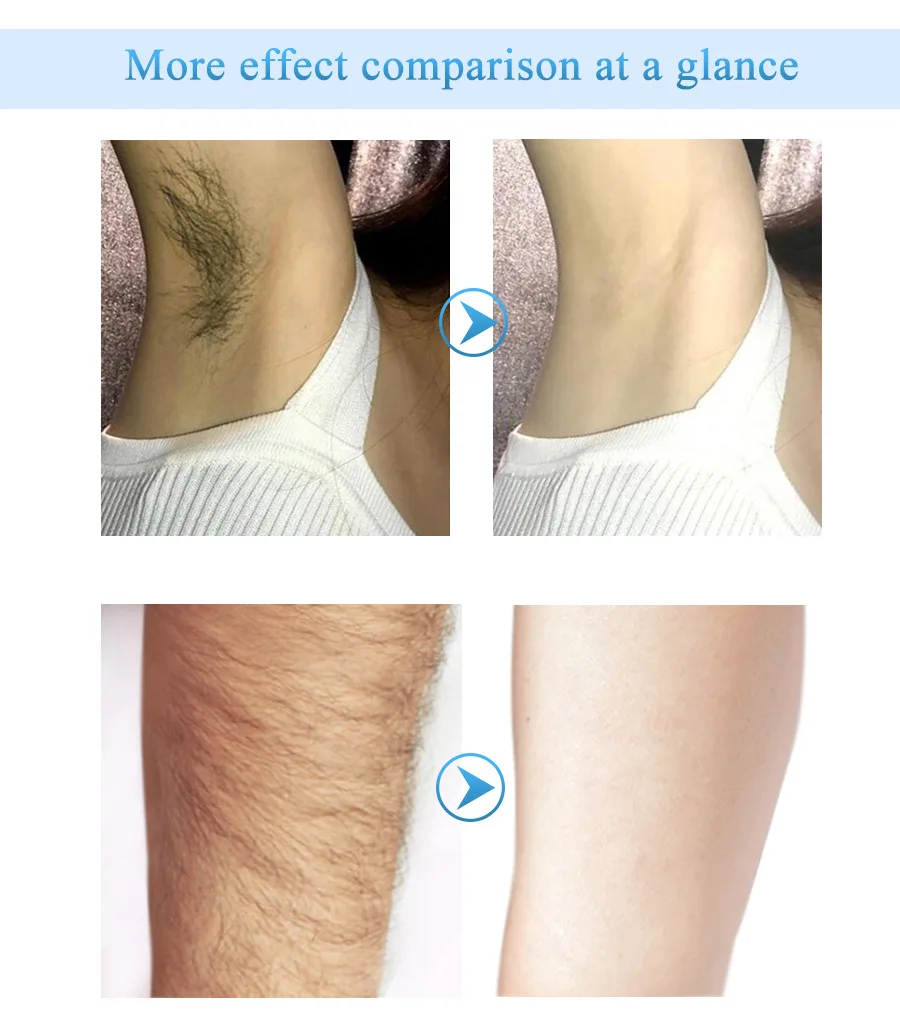 Hair removal cream (10).jpg