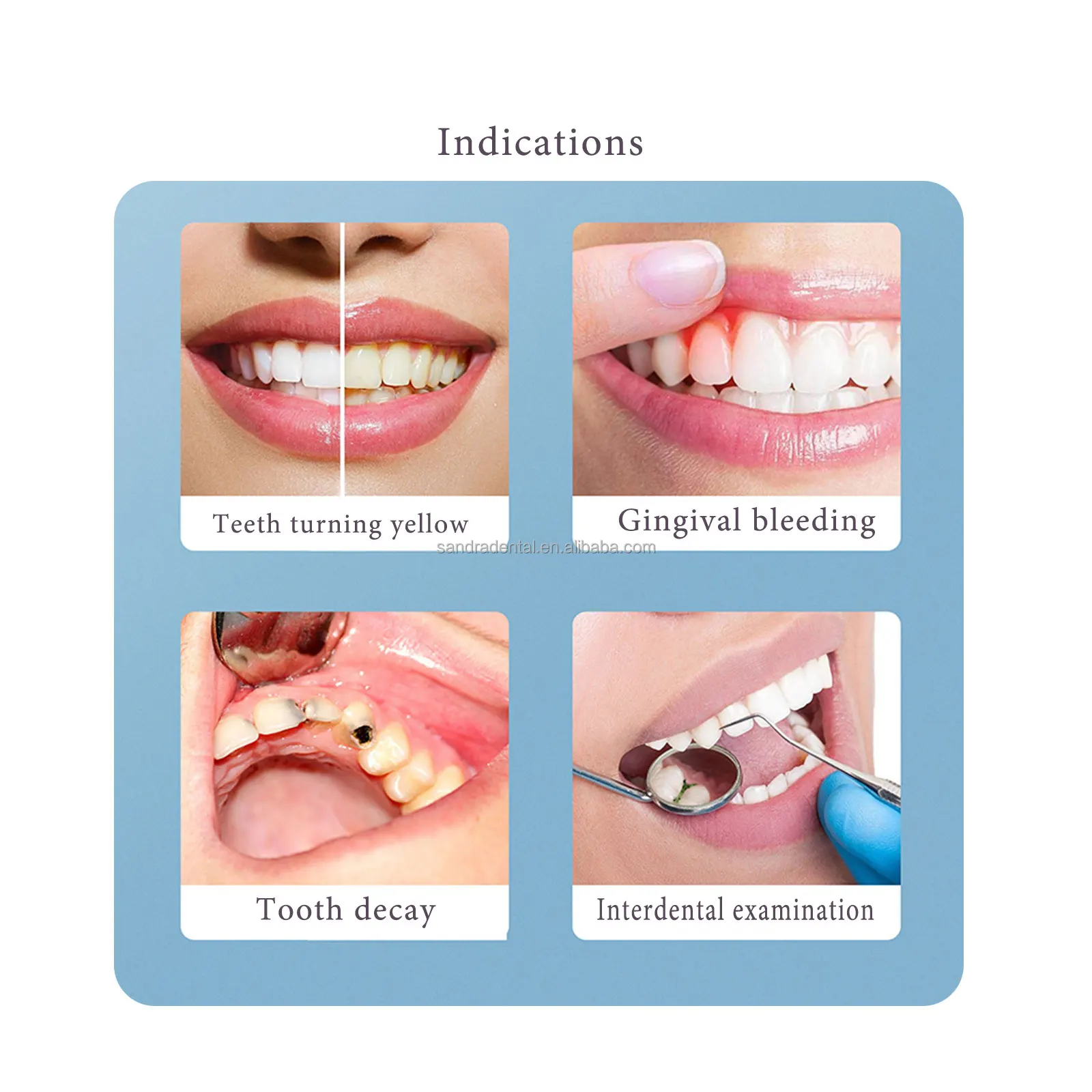 Dental Endoscope Endoscopic Intraoral Loupe Microscope Withcamera Withmonitor Intra Oral