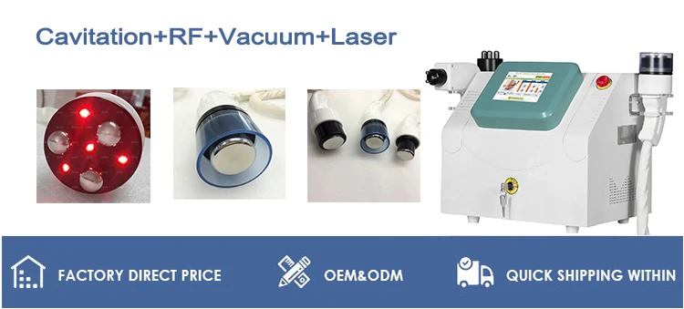 cataci&oacute;n adelgazante.jpg