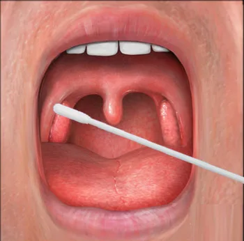 Oropharyngeal Flocked Swab