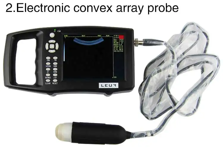 ultrasound scanner