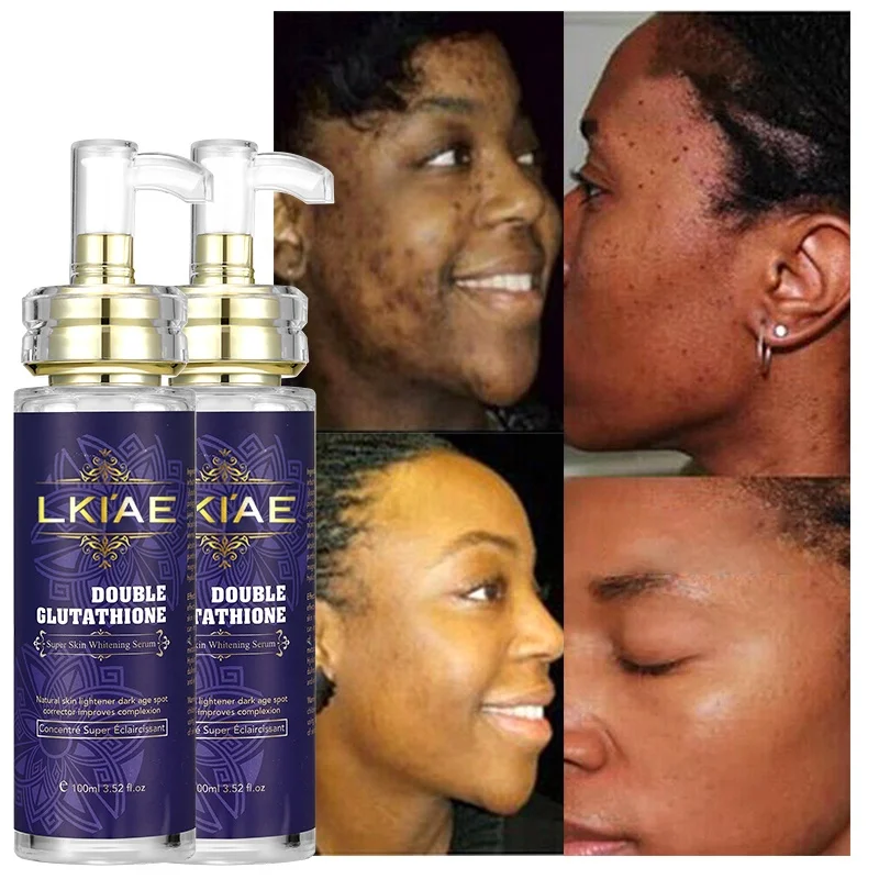 glutathione anti inflammatory Glutathione Benefits for Skin: Brightening, Anti-Aging, and More