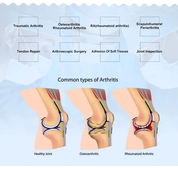 hyaluronic acid gel knee.jpg