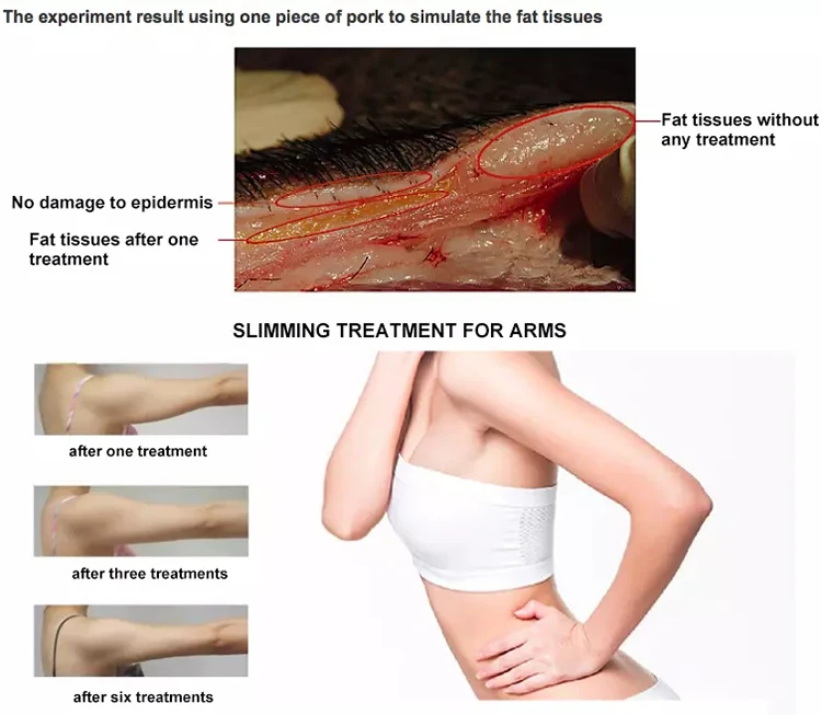 Professional 2 in 1 RF Radio Frequency Skin Tightening Equipment Body Slimming Machine