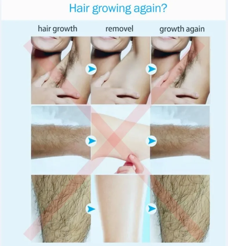  hair growth inhibitor (6).JPG