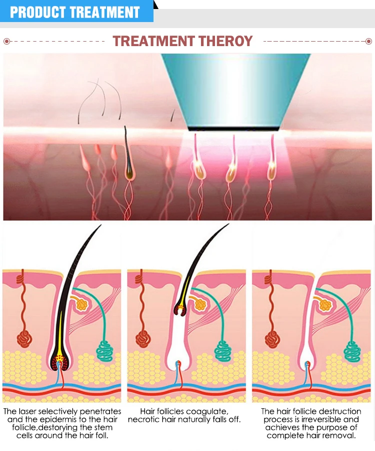 Professional Ipl Shr Laser Foto Epilator With Ce Buy Ipl Shr Laser Foto Epilator Pig Hair Removal Machine Product On Alibaba Com