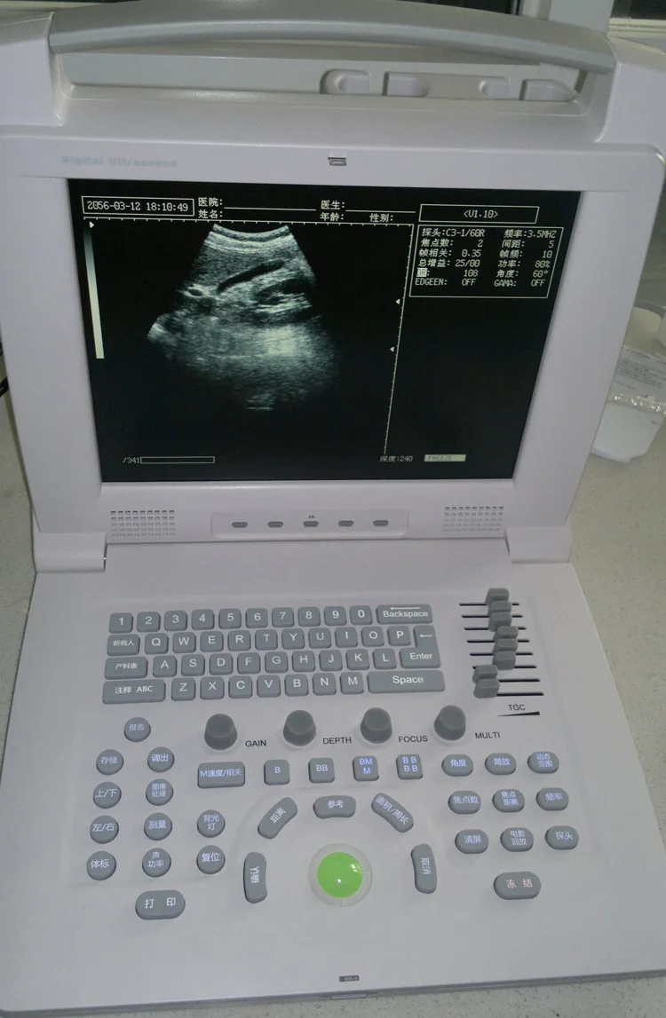 B Scan Ophthalmic Ultrasound Mindray Low Price Buy Ultrasound Machine ...