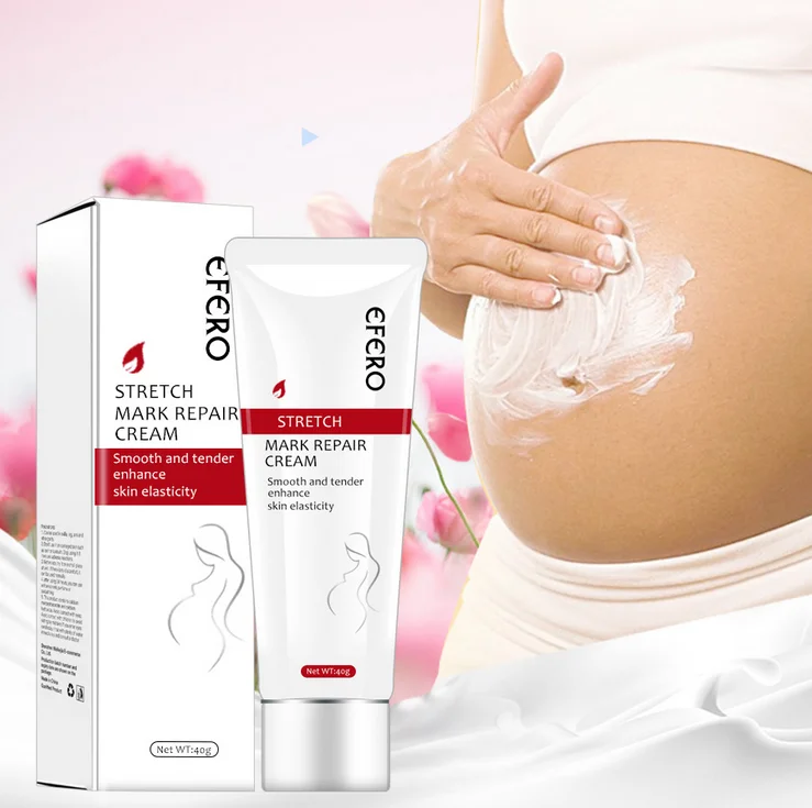 best selling stretch mark cream