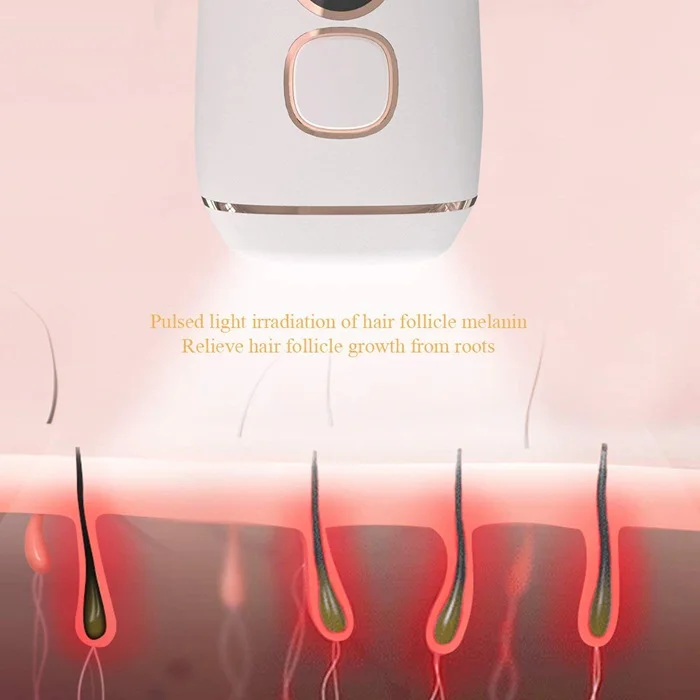 IPL Hair Removal (3).jpg
