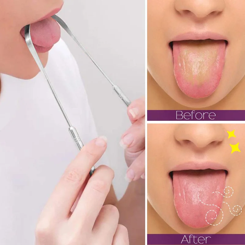 刮舌器清洁成人外科手术级不锈钢金属舌头刷牙具专业消除口臭