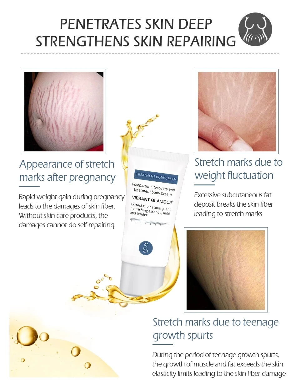 stretch marks removal-15.jpg