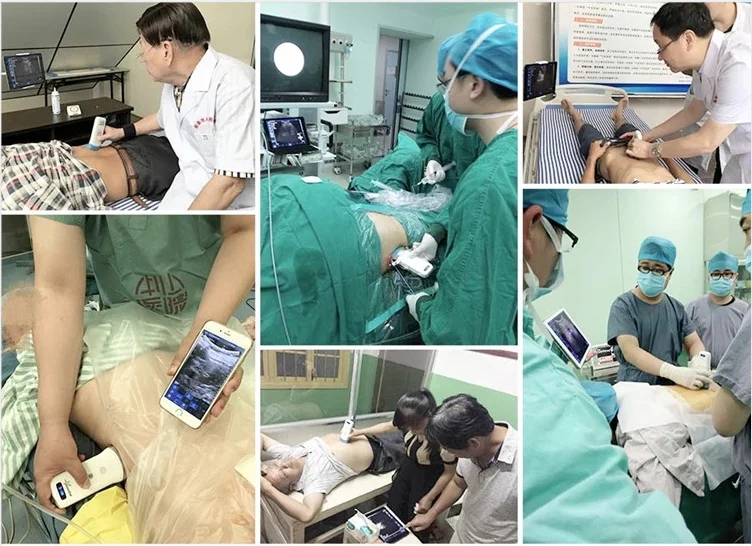 2020 New Mini Android Colorful Wireless Ultrasound Scanner Doppler Probe Ultrasound Wifi