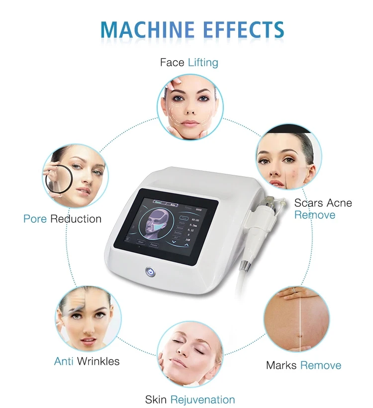 Portable Rf Microneedle Acne Scars And Stretch Mark Removal Face ...