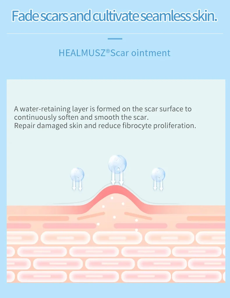 Healmusz Herbal Effective Skin Repairing Gel Natural Acne Pimple Mark ...