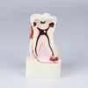 Detachable Human Teeth Models Anatomical molar teeth model medical model