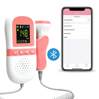 monitor fetal doppler