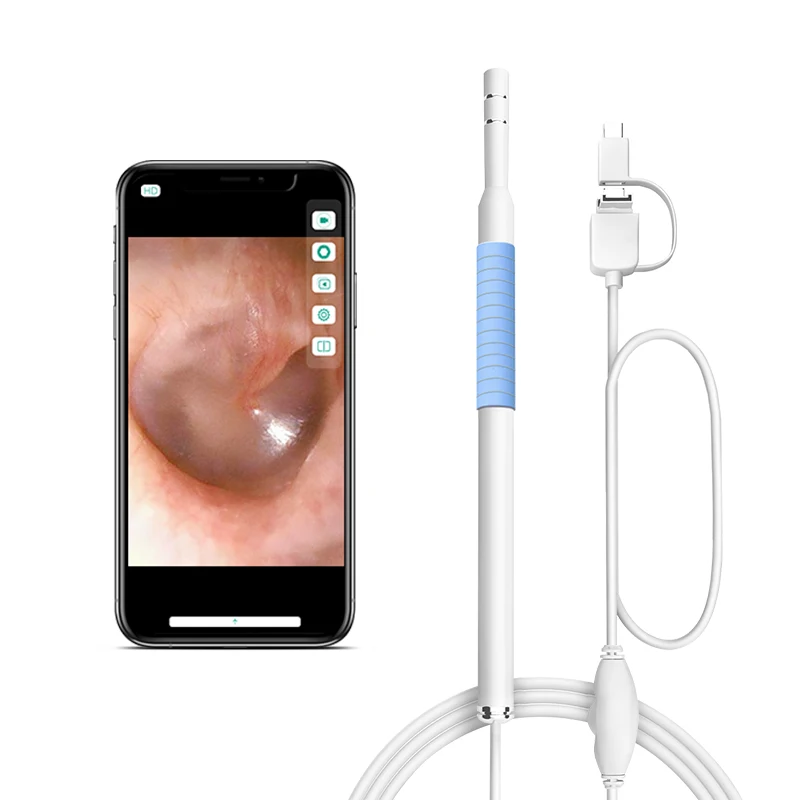Promotion Usb 720p Otoscope Portable Ear Scoop Endoscope Camera For