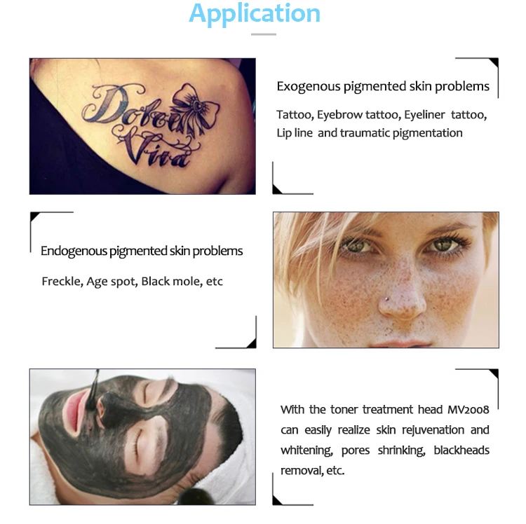 tattoo removal 3.jpg