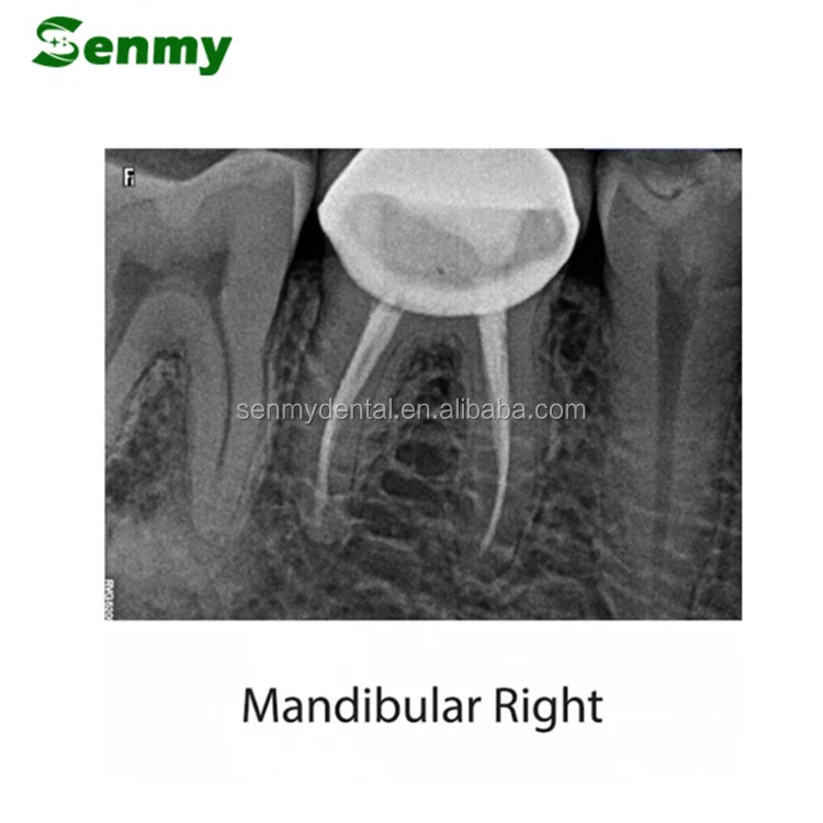 S804 Usa Carestream Kodak Dental Xray Sensor Digital Rvg 5200/6100