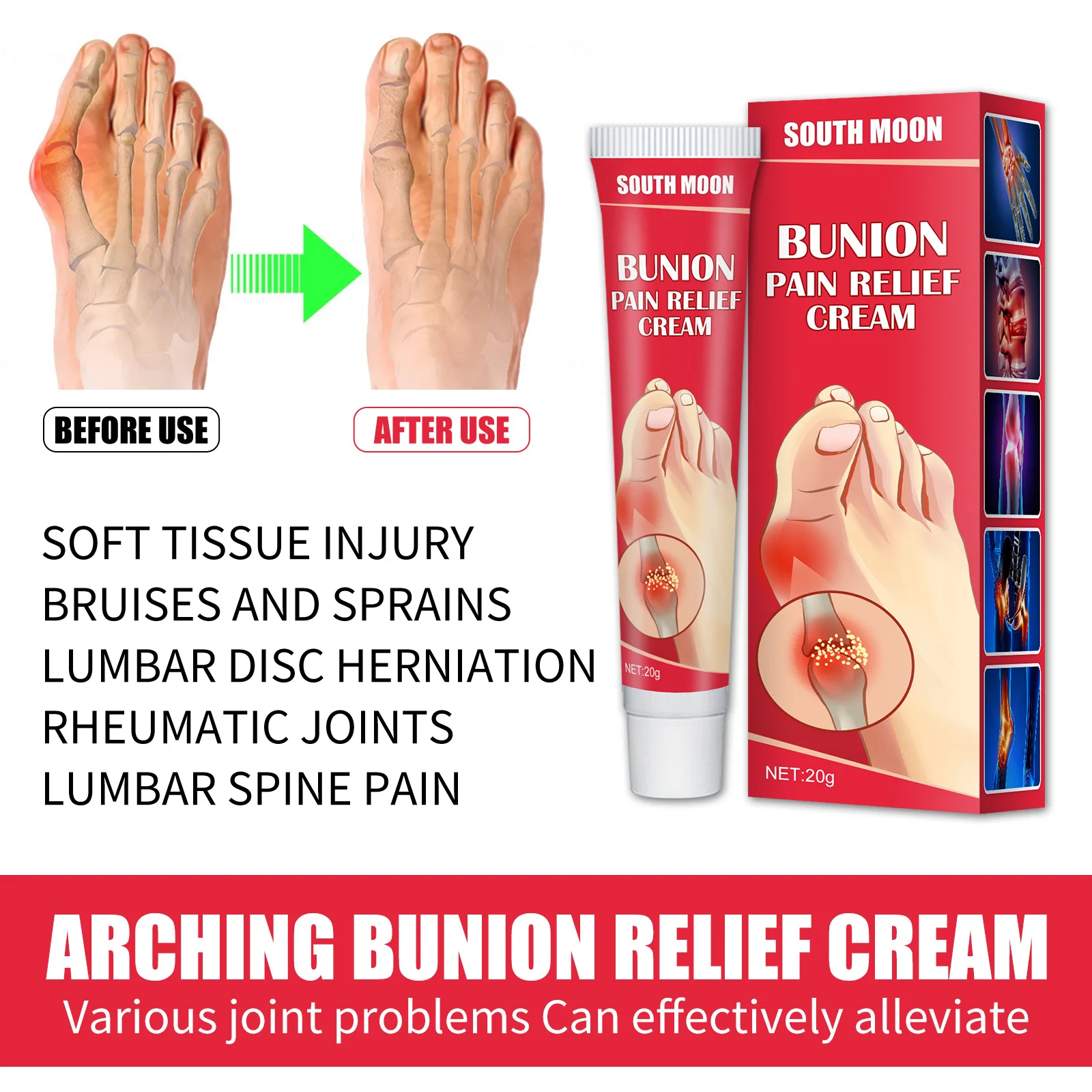 South Moon 20g Bunion Pain Relief Ointment Joint Toe Pain Cream Bunion ...