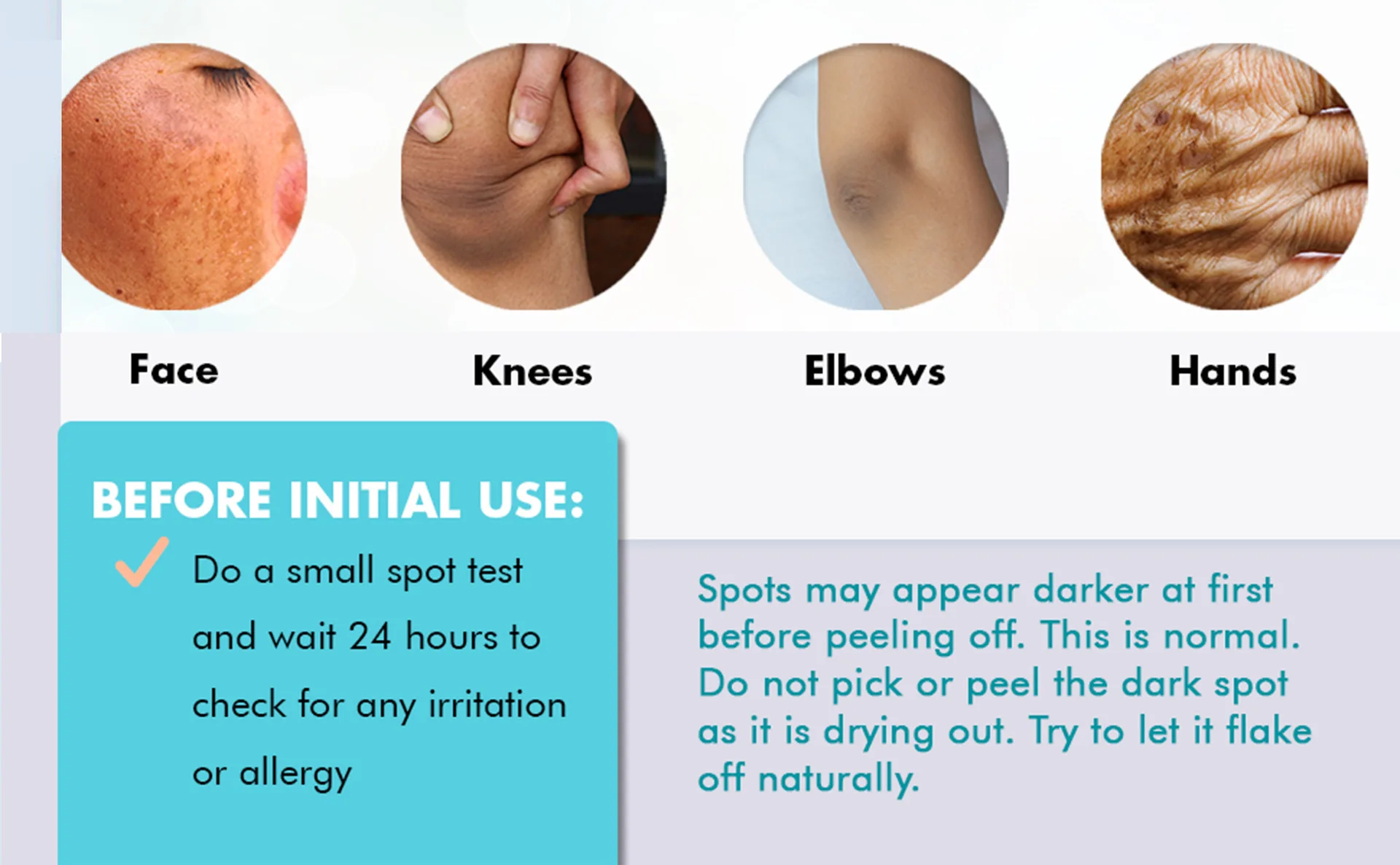 allergy spot removal cream