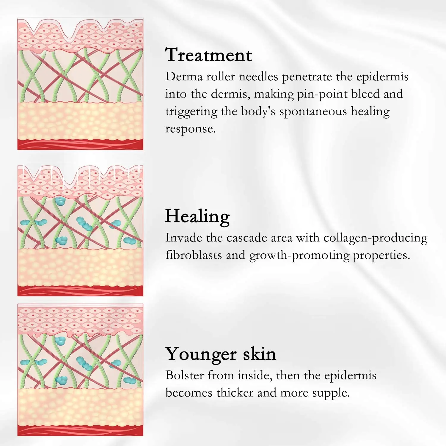 zgts derma roller