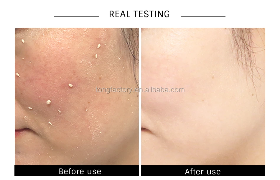 omy lady blackhead deep cleansing oxygen foam