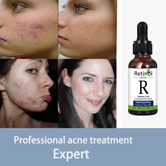 retinol original essence moisturizing skin anti-aging and fine