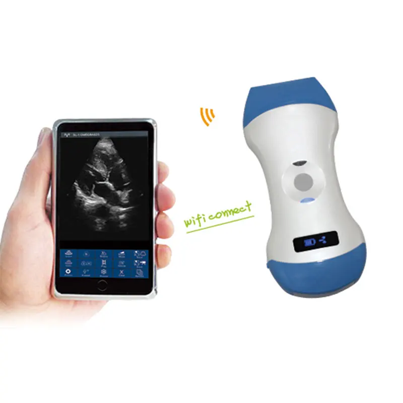 Portable Mini 5g Wireless Ultrasound Scan Probe &wifi Ultrasound