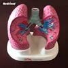 Factory Price Anatomical Human Diseased Lung Model COPD Asthma