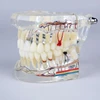 New design Implant & restoration dental model with nerve for demonstrating endo training