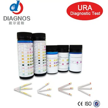 análisis de orina y sangre para diabetes