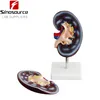 Educational Model SCIENTIFIC Human Anatomy Medical Demonstration Two Parts Kidney Model