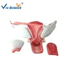 High Quality Medical Anatomical Human Uterus Model