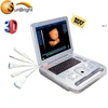 Sunbright top quality 3D clear images Ultrasound machine