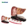Factory Price Advanced 4-stage Liver Model