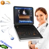 Market newest and cheapest 4D doppler ultrasound