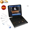 3D high end Digital laptop Ultrasound Scan